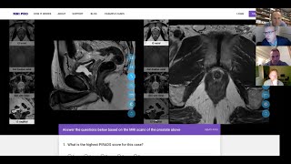 PROSTATE IMAGING WEBINAR APR20
