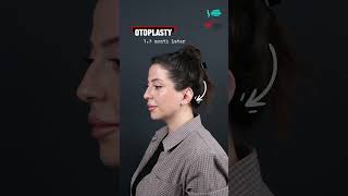 Otoplasti 1.5 Ay Sonrası Doğal Görünüm Çekulak