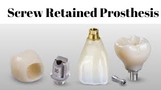 Implant Prosthetic Solutions: ScrewRetained Prosthesis, Jig trial, Implant level impression