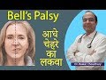 Bell's Palsy | Best Treatment of Bell's Palsy | Best Homeopathic Doctor in India