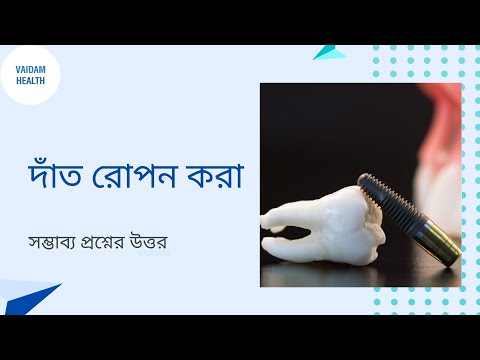 ভিডিও: একটি সংশ্লেষকে কীভাবে সংযুক্ত করবেন