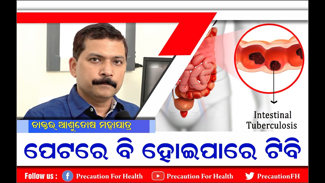 Treatment For Abdominal Tuberculosis ପେଟରେ କାହିଁକି ହୁଏ ଟିବି ଓ କିଭଳି କରିବେ ଚିକିତ୍ସା  पेट का टीबी इलाज