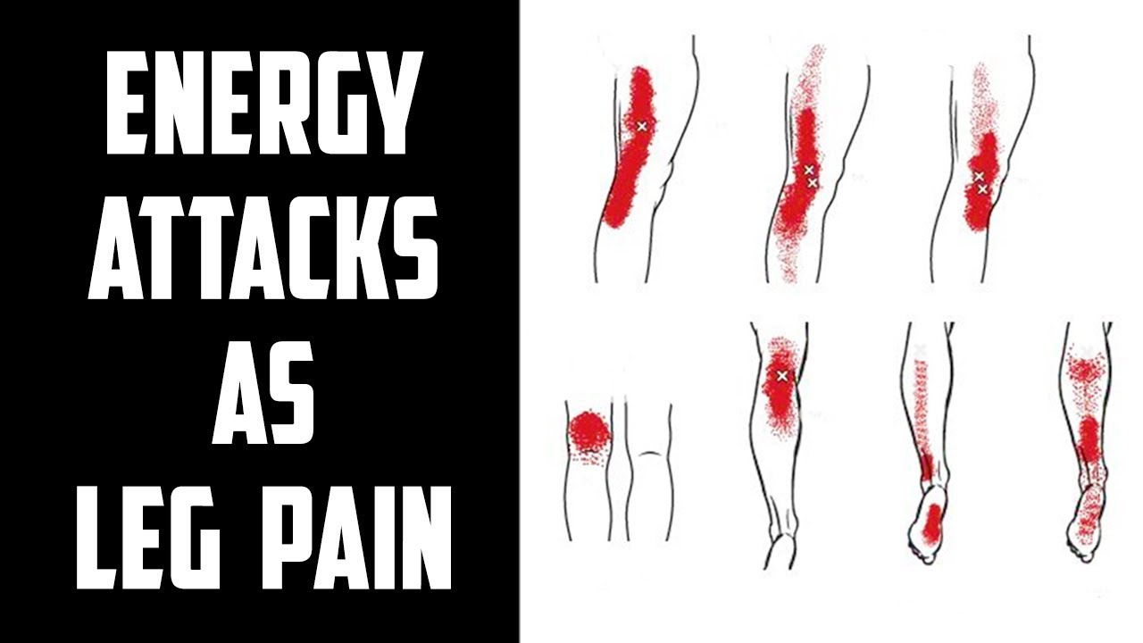 Energy Attacks Manifest As Leg Pain? | Sufi Meditation Center