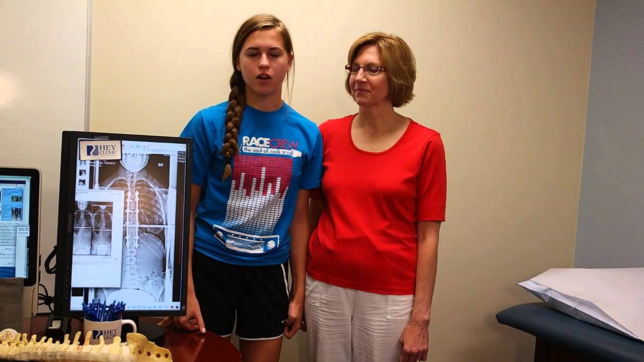 Can a 15yo multiathlete return to sports after scoliosis fusion? YouTube
