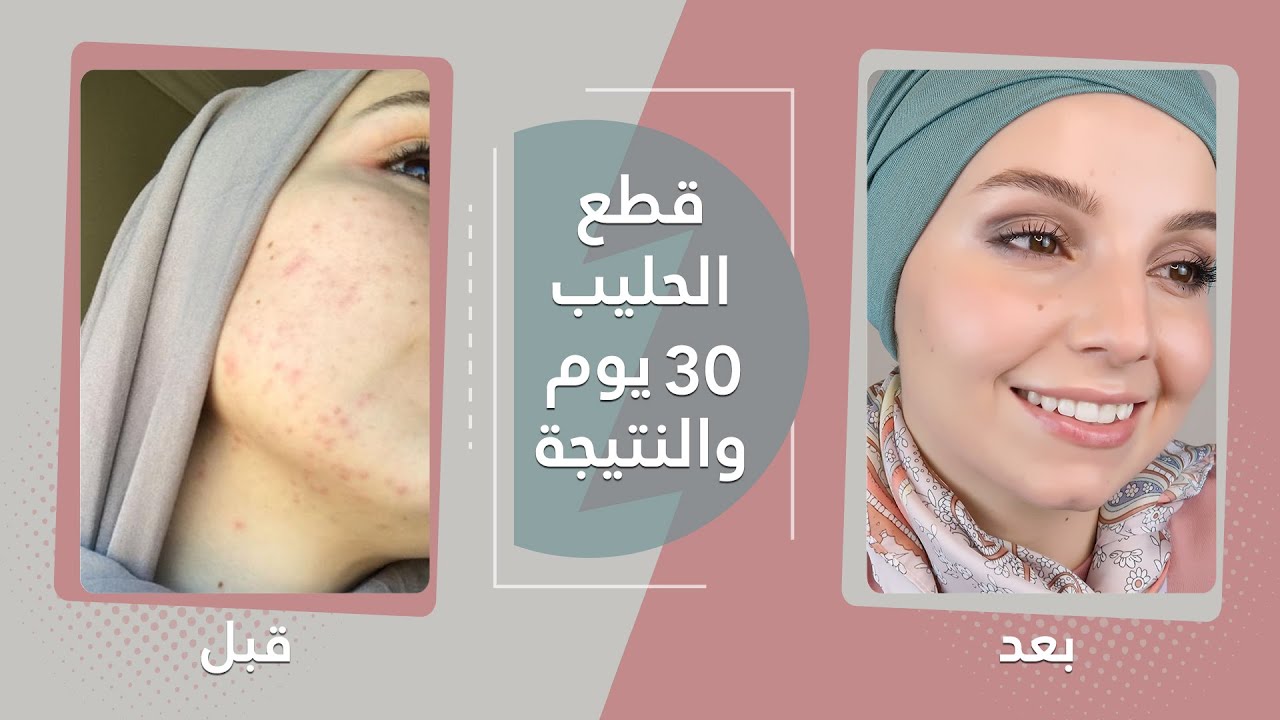 قطعت الحليب 30 يوم !!! و النتيجة غير متوقعة !!!!