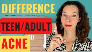 DIFFERENCE between ADULT and TEEN ACNE – What you NEED to know!