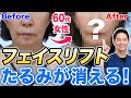 【フェイスリフト】60代女性がここまで若返る！最新症例解説