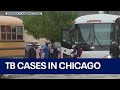 &#39;Small number&#39; of tuberculosis cases reported among Chicago migrants