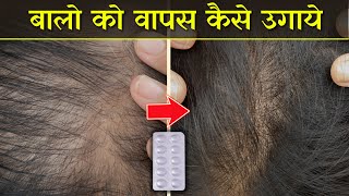 H-vit Hair | बाल झड़ना, सफ़ेद बाल, गंजापन, पतले बाल | best hair supplement for hairfall | Hindi