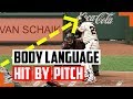 How To Know When The Pitcher Intentionally Hit The Batter – Body Language Secrets