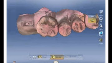 Cerec Connect 4.3 to Cerec Chair Side SW