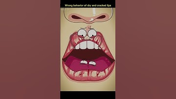 Thumbnail of Dry and cracked lips