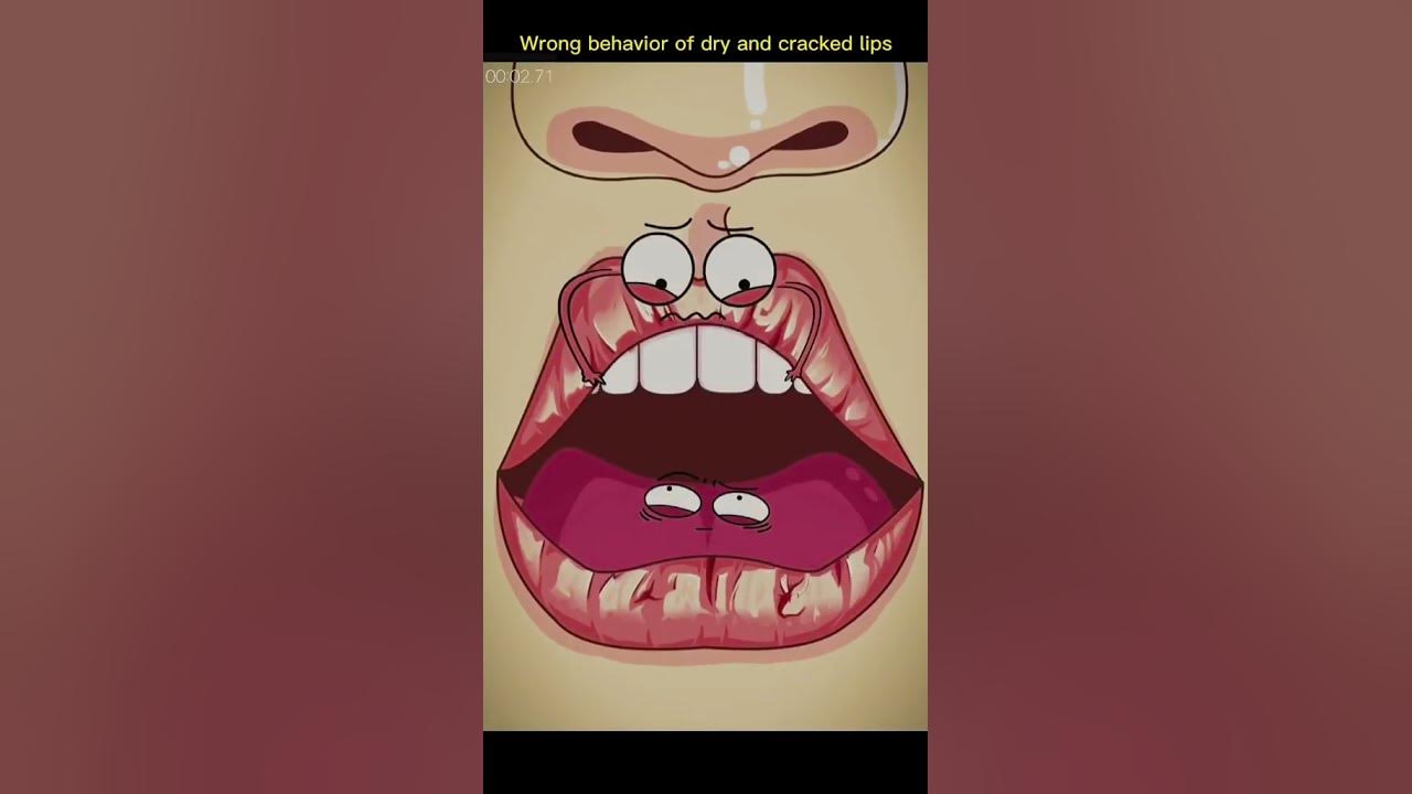Dry and cracked lips