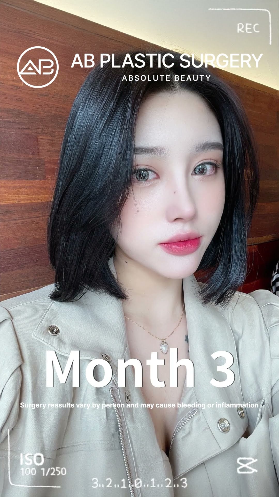 You Won’t Believe This Transformation Jaw & Nose Surgery Before & After #shorts