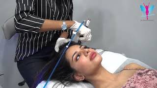 Hydrafacial - Keravive | Hollywood Scalp Facial | Scalp Treatment | #keravive #hydrfacial