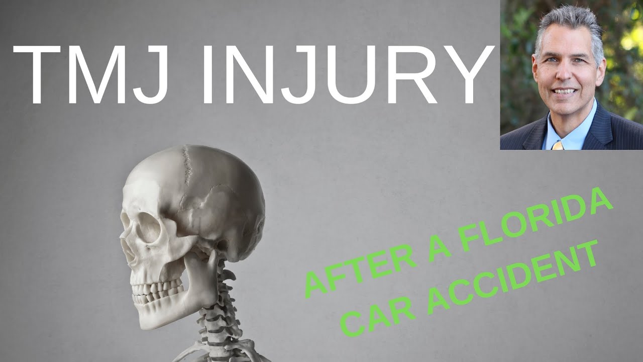 TMJ Injury After an Indiana Car Accident Michigan City Injury Lawyer
