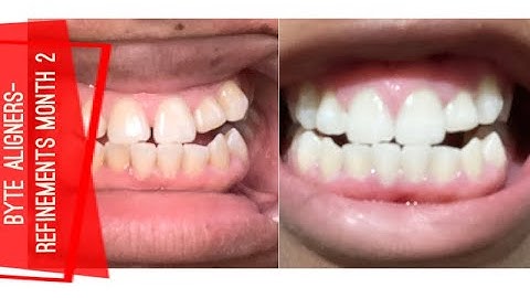 Byte Journey: Awesome Refinements | Ben and Cin