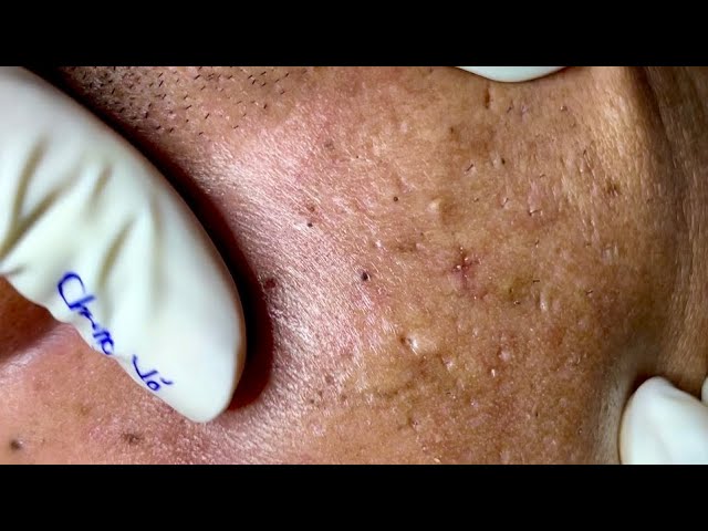 Satisfying video with Chung Vo Spa | 210
