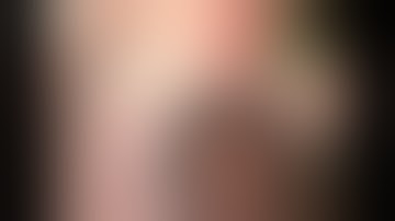 "Glued In"  Lens:  Aaren EC3 PAL by Steven G. Safran MD