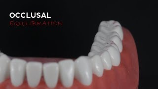 01B   Occlusal Equilibration