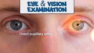 Examination of the Eyes and Vision  OSCE Guide (old version) | UKMLA | CPSA