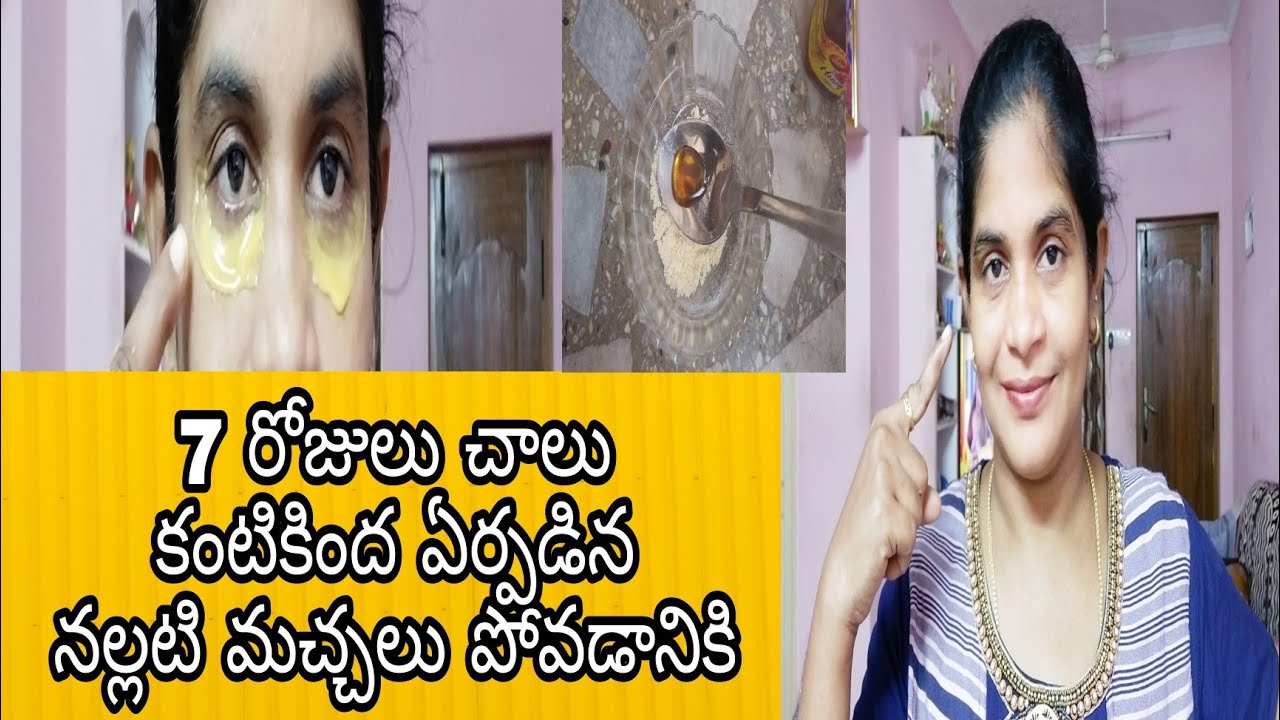 How to Remove Dark circles😎 //Under Eye Dark Circles home remedies in