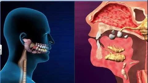 CBSE Class 11 Biology || Digestion of Food