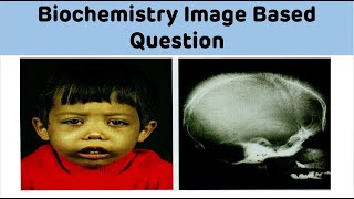 Biochemistry || Image Based Question - 3 || Dr Amit Maheshwari