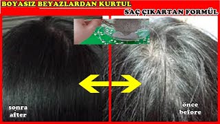 MIX THIS WITH BLACK SEED AND LOSE WHITE HAIR OQUCKLY #StopHairLoss #BlackSeedMask screenshot 4