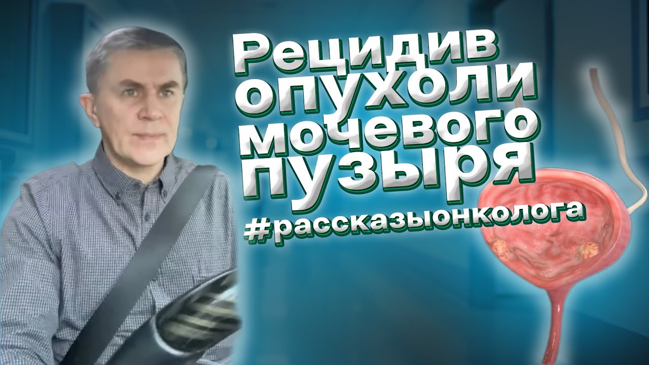 Рецидив опухоли мочевого пузыря - YouTube