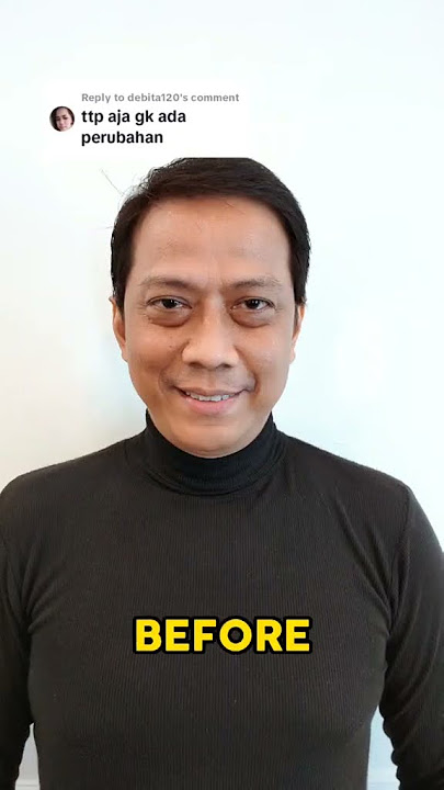 Kantung Mata Bisa Hilang?