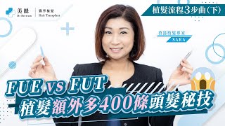 植髮流程三步曲 (下) 打孔植入篇：一次多400條頭髮 FUT+FUE 植髮秘技｜植緊髮 顯微鏡睇番自己毛囊係咩樣!｜最高存活率嘅毛囊植入技術｜美絲植髮 - 香港植髮專家 Sara（廣東話、中文字幕）