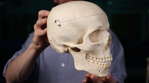 Labelled skull sutures