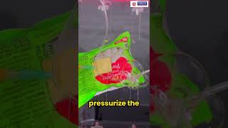 Pouch Leak Detection Test – ASTM F2096 Ensuring Seal Integrity!