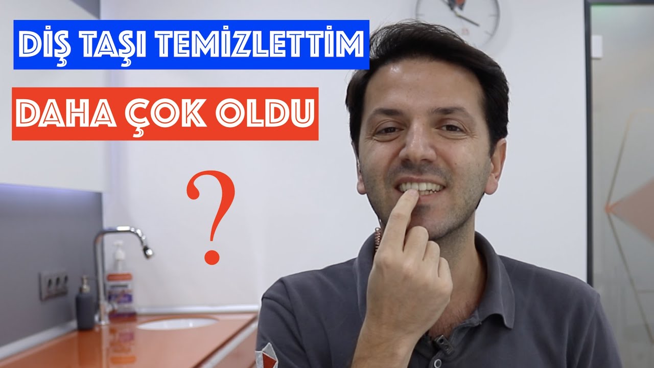 Diş Taşı Temizliği Sonrası Daha mı Çok Oluşur ?