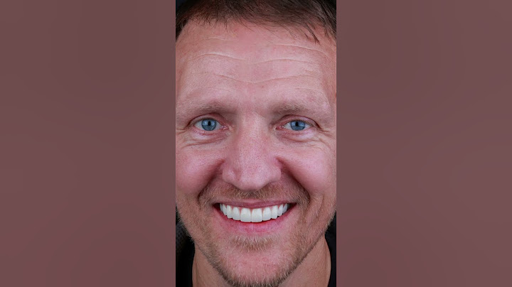 His life completely changed #beforeandafter #transformation #smile