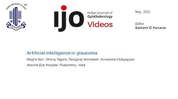 Artificial intelligence in glaucoma