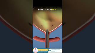 Blood in Urine The Cystoscopy Procedure Explained