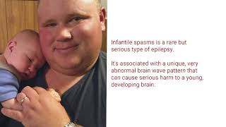 Seth Bailey Rare Artist 2023