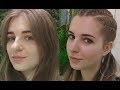 Download Моя РИНОПЛАСТИКА носа | До и ПОСЛЕ | Отзыв Яны Моя РИНОПЛАСТИКА носа | До и ПОСЛЕ | Отзыв Яны