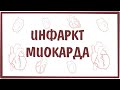 Инфаркт Миокарда