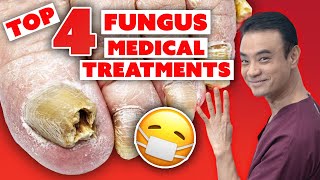 4 MEDICAL treatments to get rid of toenail fungus | Holistic Toenail Fungus Cures Part 3 | Dr. Kim