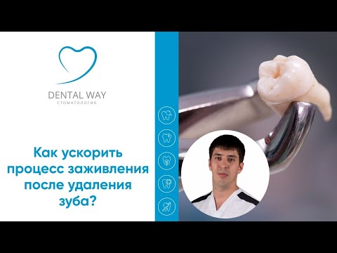Как ускорить процесс заживления после удаления зуба