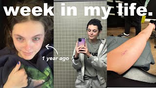 an EMOTIONAL week in my life. | my cancer anniversary, getting a tattoo, &amp; check up appointments