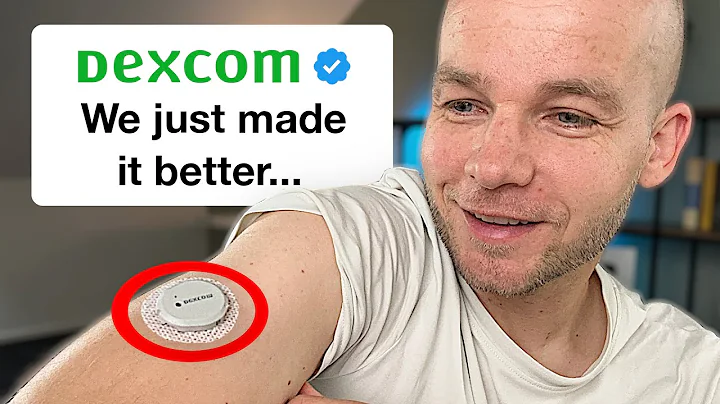 Dexcom G7 Major Upgrades Revealed – Don’t Miss Out!