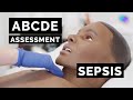 Abcde assessment  sepsis  emergency simulation scenario  osce guide  ukmla  cpsa