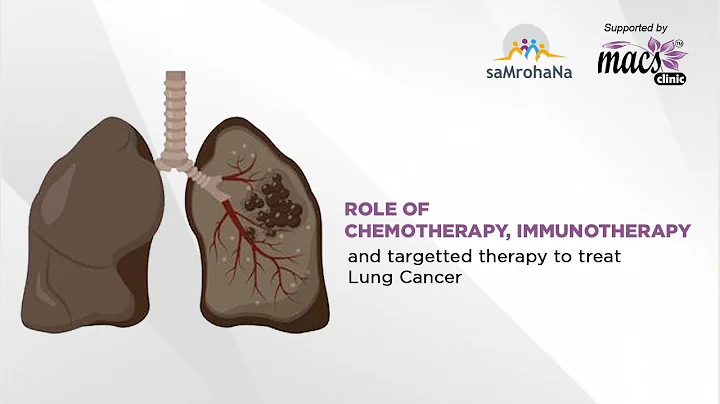 Role of Chemotherapy, Immunotherapy and Targeted Therapy to treat Lung Cancer | Episode 24