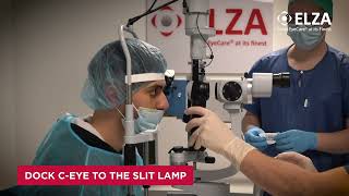 Full Cross-Linking (CXL) at the Slit Lamp April  2023 Guide
