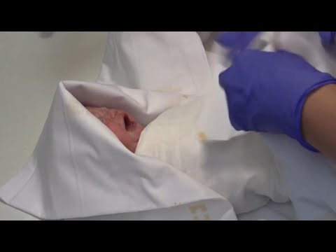 Video: The Girl Was Born 117 Days After The Death Of The Mother's Brain - Alternative View