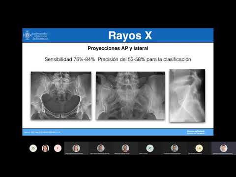 Vídeo: Arcos Altos: Diagnóstico, Problemas Relacionados Y Opciones De Tratamiento